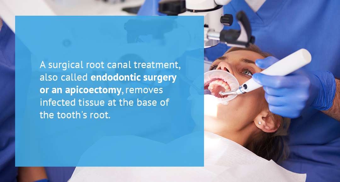What Is a Surgical Root Canal
